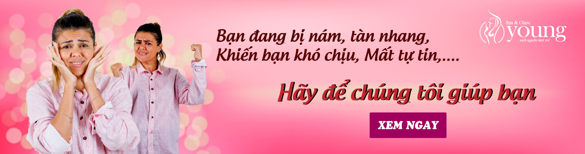 Điều trị nám hiệu quả chỉ sau 1 liệu trình tại Young Spa