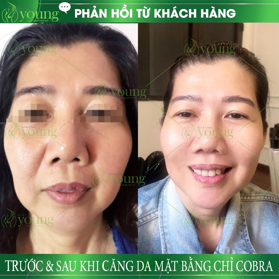 cang da mat bang chi la gi gia bao nhieu o dau tot 1141 5 1