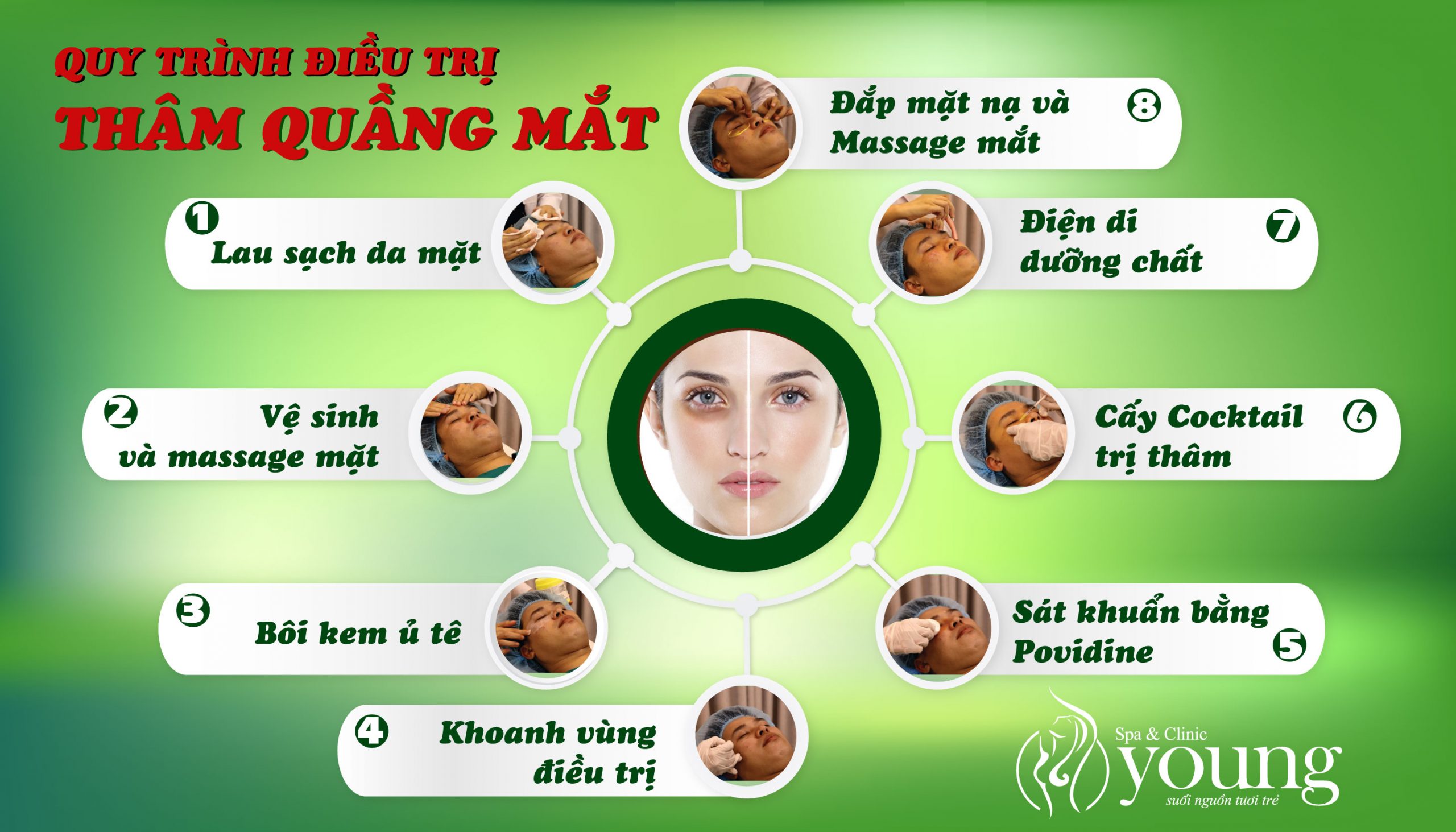 Quy trình điều trị thâm quầng mắt