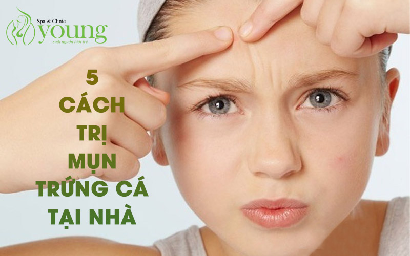 5 cách điều trị mụn trứng cá hiệu quả tại nhà