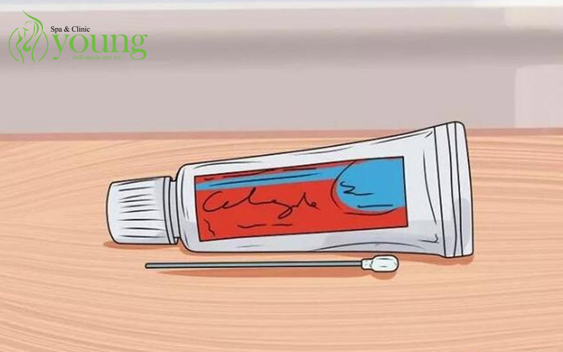 Cách trị mụn nhanh nhất trong 1 ngày tại nhà