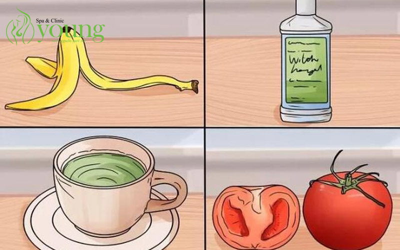 Cách trị mụn nhanh nhất trong 1 ngày tại nhà