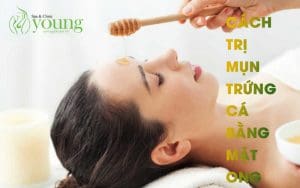 Cách trị mụn trứng cá bằng mật ong hiệu quả nhất