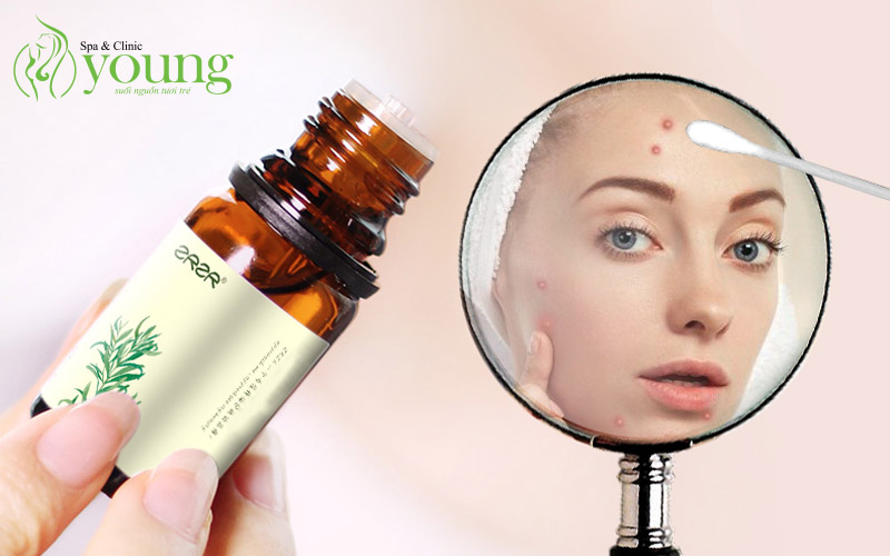 Mặt bị mụn trứng cá làm sao để hết mà không dùng thuốc