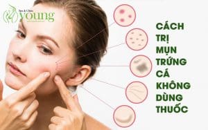 Mặt bị mụn trứng cá làm sao để hết mà không dùng thuốc