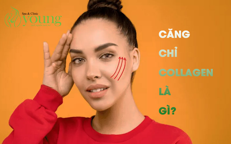 Căng chỉ collagen là gì? Các loại chỉ căng da an toàn