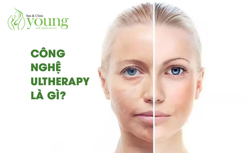 Công nghệ Ultherapy là gì?
