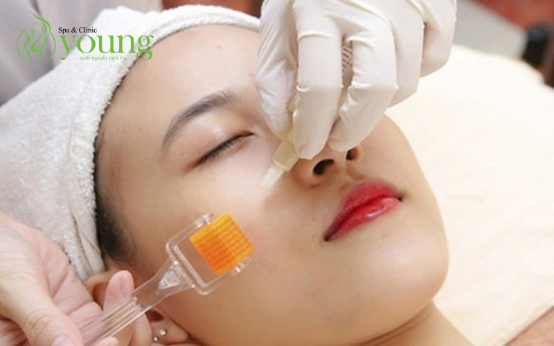 Điều trị sẹo rỗ bằng phương pháp nào tốt nhất?