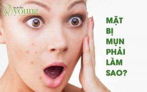 Mặt bị mụn phải làm sao? Cách trị mụn hiệu quả tại nhà từ thiên nhiên