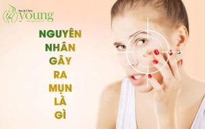 Nguyên nhân gây ra mụn, các loại mụn thường gặp