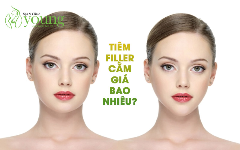 Tiêm filler cằm giá bao nhiêu? Những lưu ý khi tiêm filler cằm