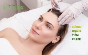 tìm hiểu tiêm filler, công dụng của tiêm filler.