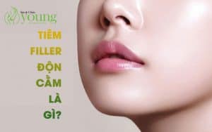 Tiêm filler độn cằm là gì ? Tiêm filler độn cằm giá bao nhiêu?