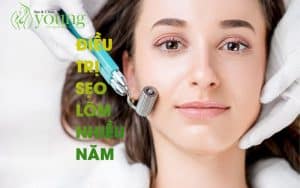 Điều trị sẹo lõm lâu năm trên mặt bằng cách nào?
