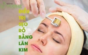 Điều trị sẹo rỗ bằng phương pháp lăn kim có gì?