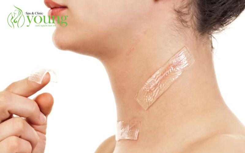 Điều trị sẹo rỗ bằng phương pháp nào hiệu quả nhất