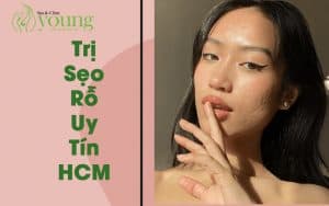 Trị sẹo rỗ uy tín TPHCM, quy trình trị sẹo rỗ như thế nào?