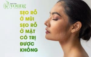 Sẹo rỗ ở mũi, sẹo rỗ ở mặt có điều trị được không?