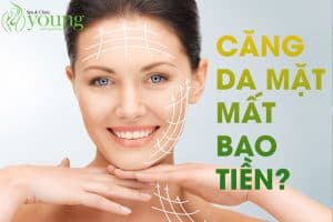 Căng da mặt mất bao nhiêu tiền?